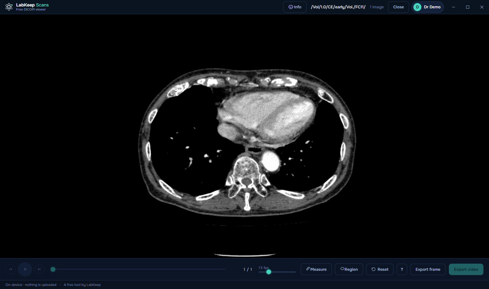 LabKeep Scans opening a preamble-less Toshiba CT export most tools refuse to recognise as DICOM