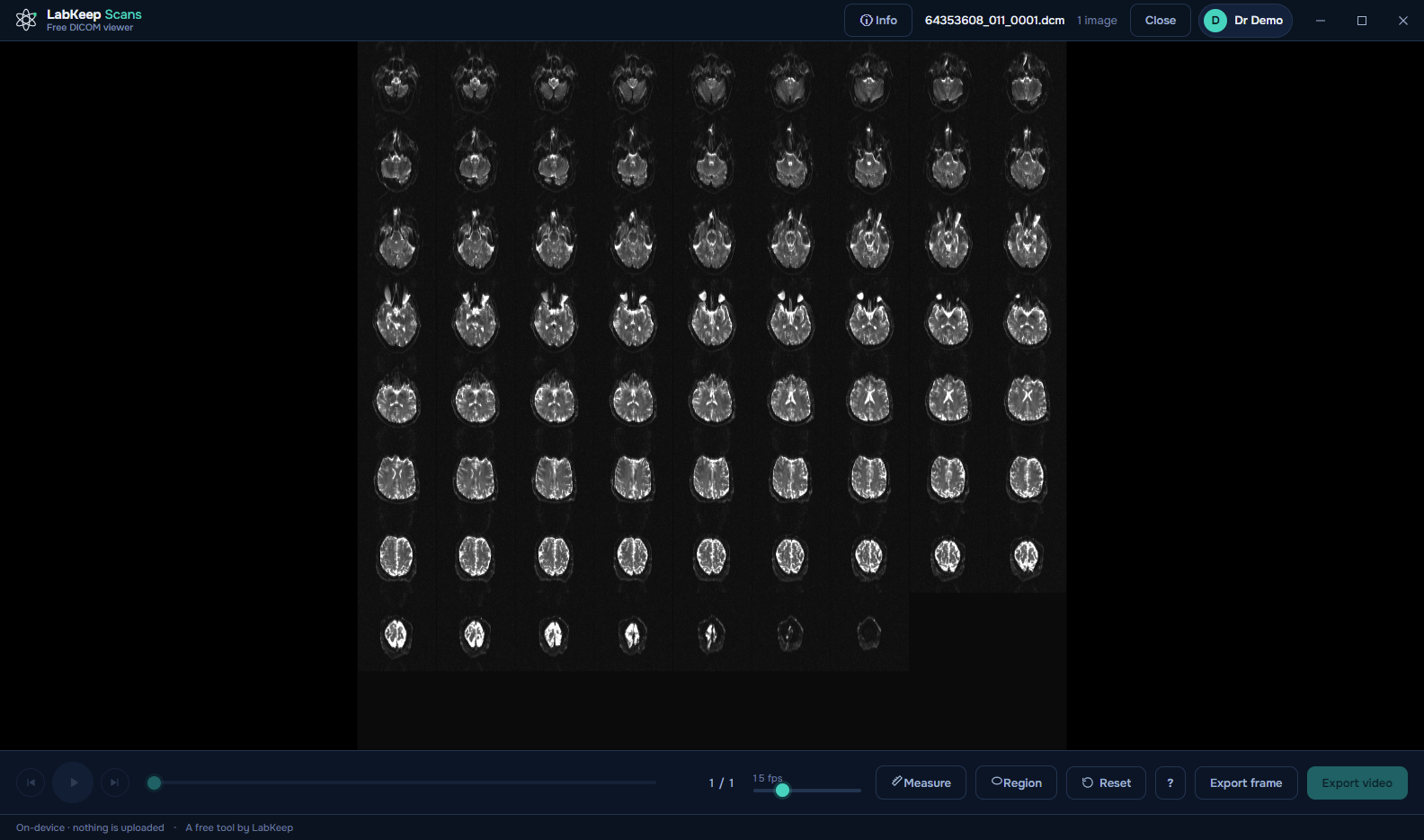 LabKeep Scans opening a decade-old Explicit VR Big Endian MRI archive