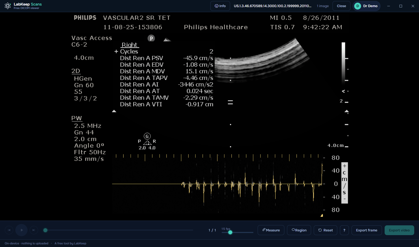 LabKeep Scans rendering a PALETTE COLOR ultrasound Doppler study with waveform trace