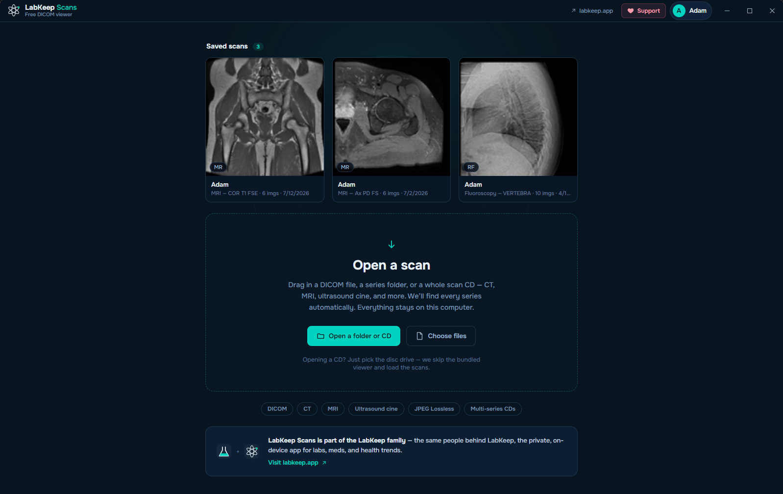 The LabKeep Scans home screen with saved scans and the Open a scan dropzone