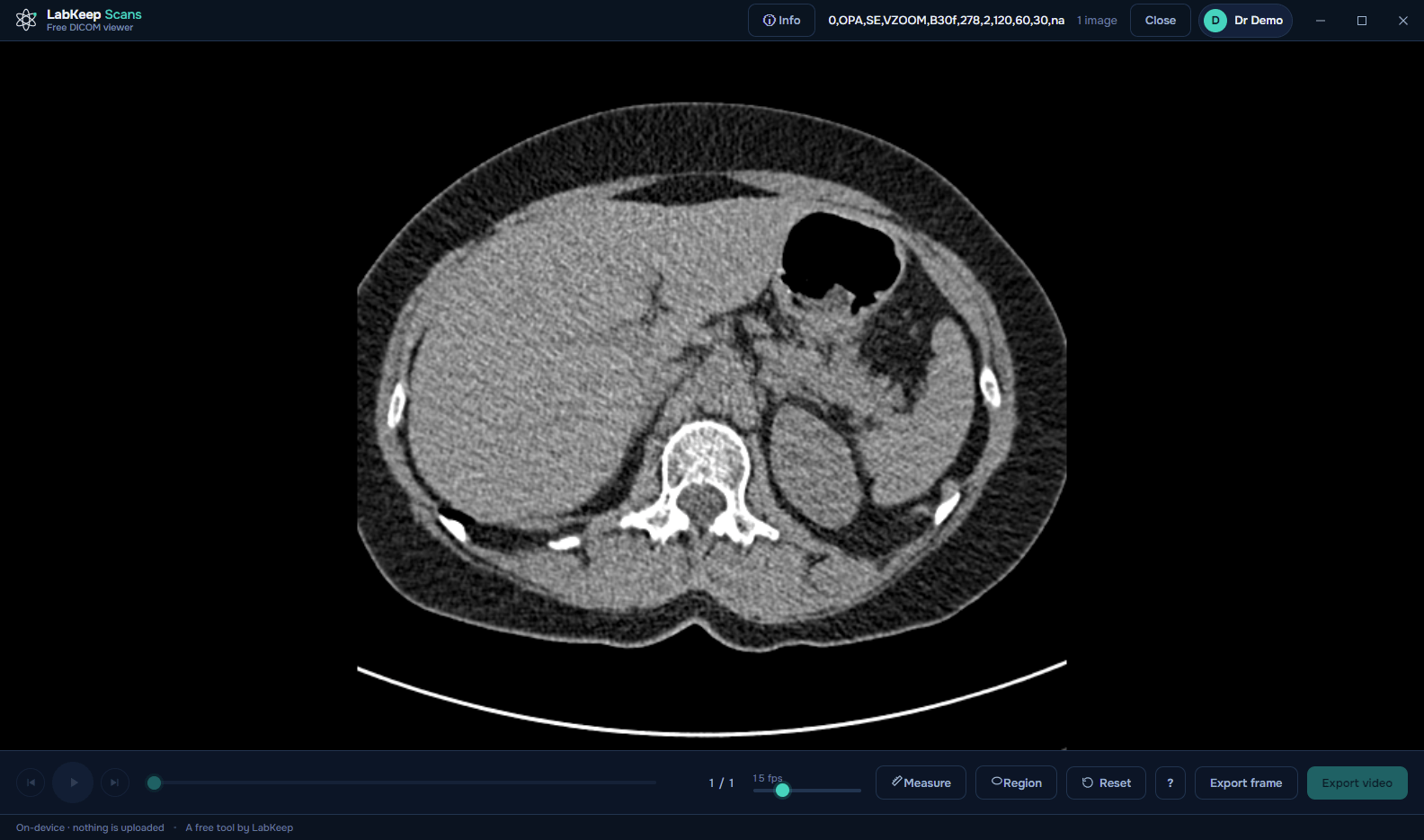 LabKeep Scans displaying a chest CT scan