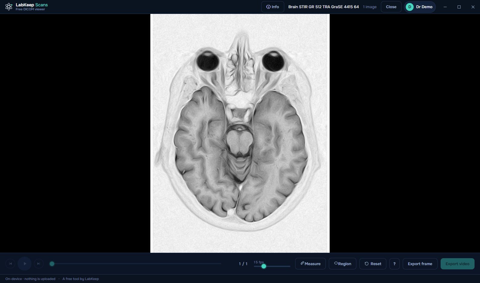 LabKeep Scans displaying an MRI brain scan