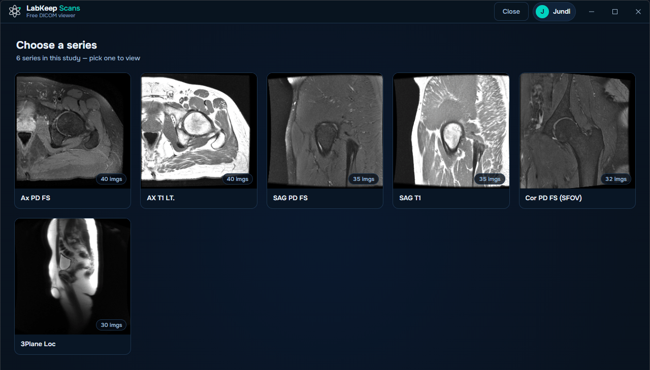 LabKeep Scans showing every MRI series found on a hospital disc